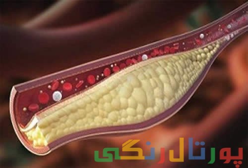 تاثیر عرق کاسنی و شاتره در کاهش چربی خون