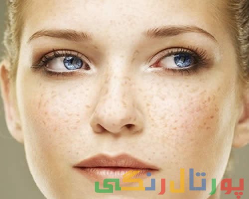 با کک و مک چه کنیم؟