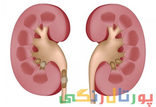 علائم از کار افتادن کلیه را بشناسید