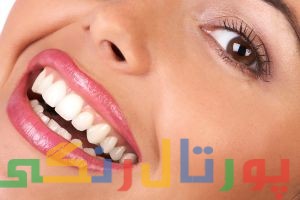 چگونه با آرایش دندان های مان را سفید کنیم؟