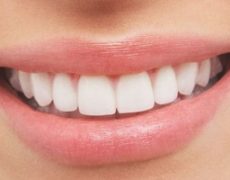 آیا روش های طبیعی برای جلوگیری از پوسیدگی دندان وجود دارد؟