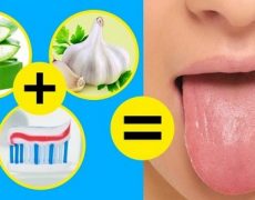درمان سفیدی زبان با 10 روش موثر