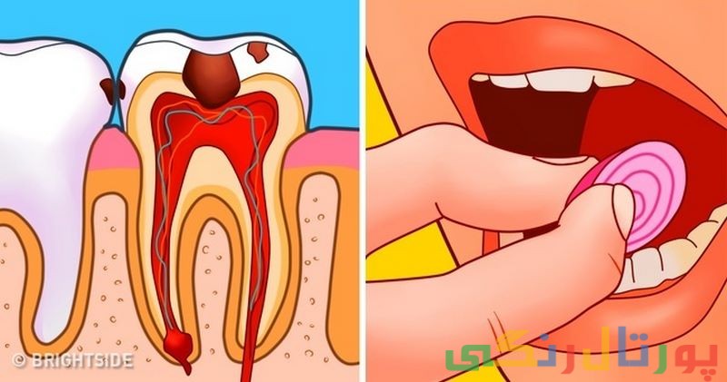 8 روش درمان خانگی دندان درد