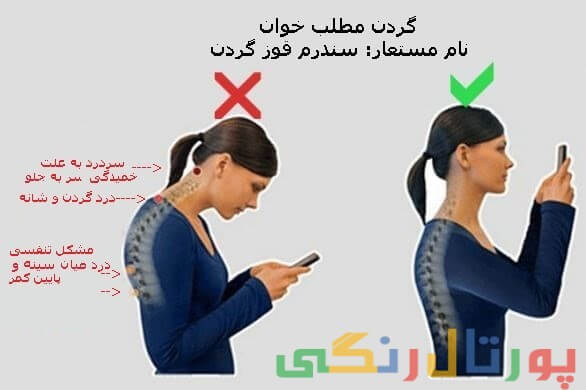 نحوه ایستادن خود را بهبود بخشید