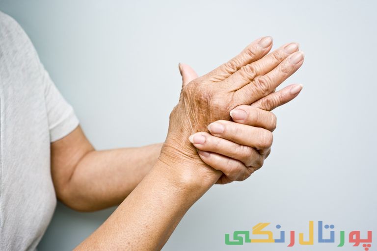 علائم اولیه آرتریت را بشناسید