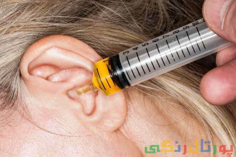 چگونه می توان گوش کیپ شده خود را باز کرد؟