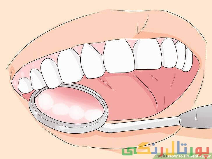 پاکسازی دندان‌ها به طور حرفه‌ای