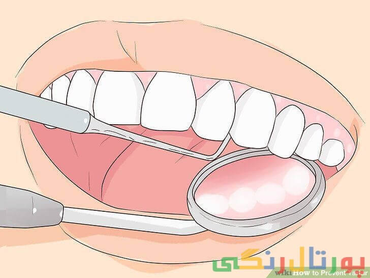 پاکسازی دندان‌ها به طور حرفه‌ای