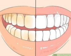 جرم گیری دندان در خانه/جرم گیری دندان به روش سنتی/بهترین جرم گیر دندان